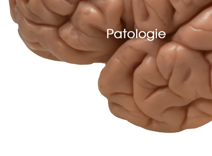 Patologie